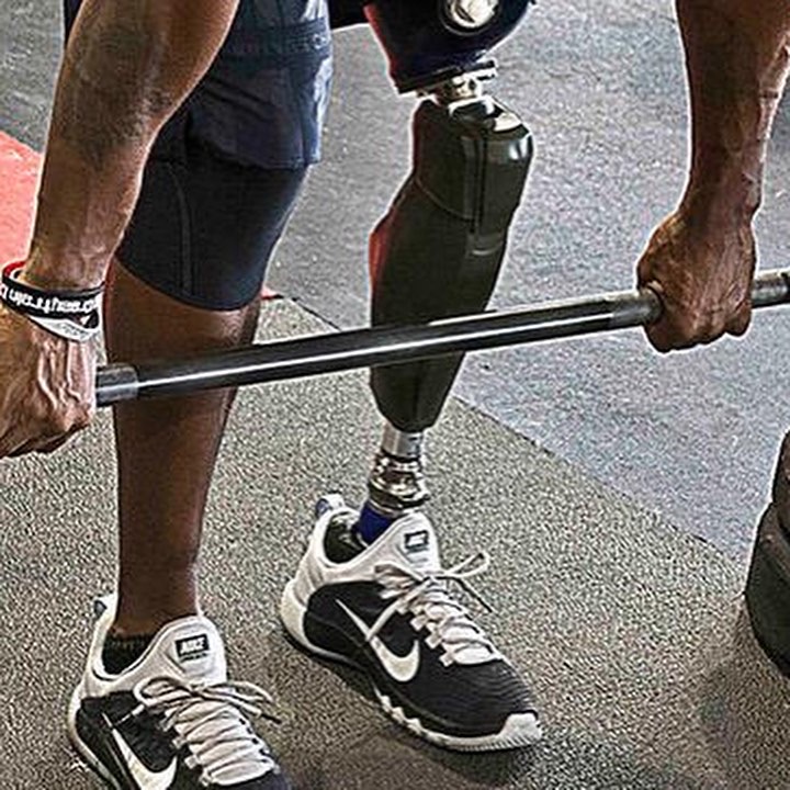 Personal Training met een beenamputatie